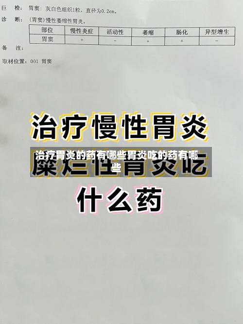 治疗胃炎的药有哪些胃炎吃的药有哪些